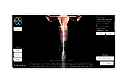 Web-based Simulator for Bayer IUDs